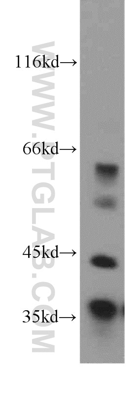 Western Blot (WB) analysis of mouse heart tissue using MFAP4 Polyclonal antibody (17661-1-AP)