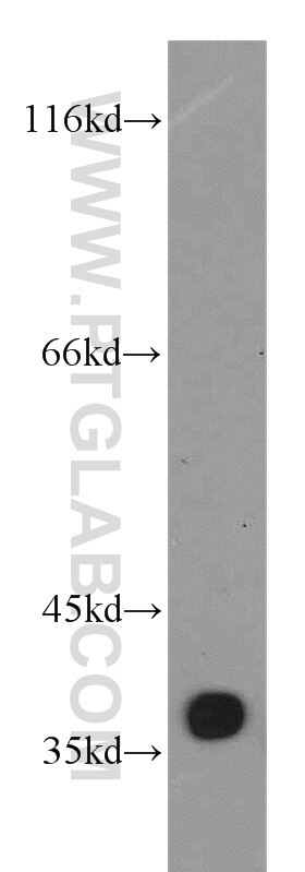 WB analysis of mouse lung using 17661-1-AP