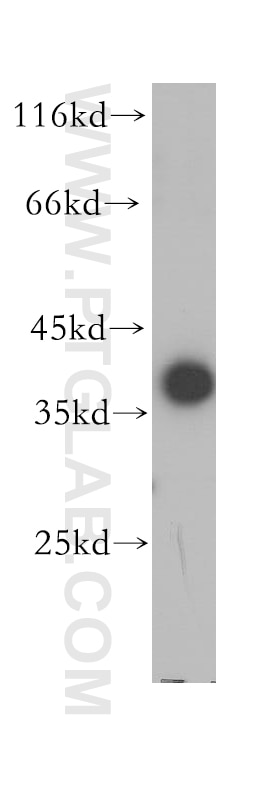 Western Blot (WB) analysis of human kidney tissue using MFAP4 Polyclonal antibody (17661-1-AP)