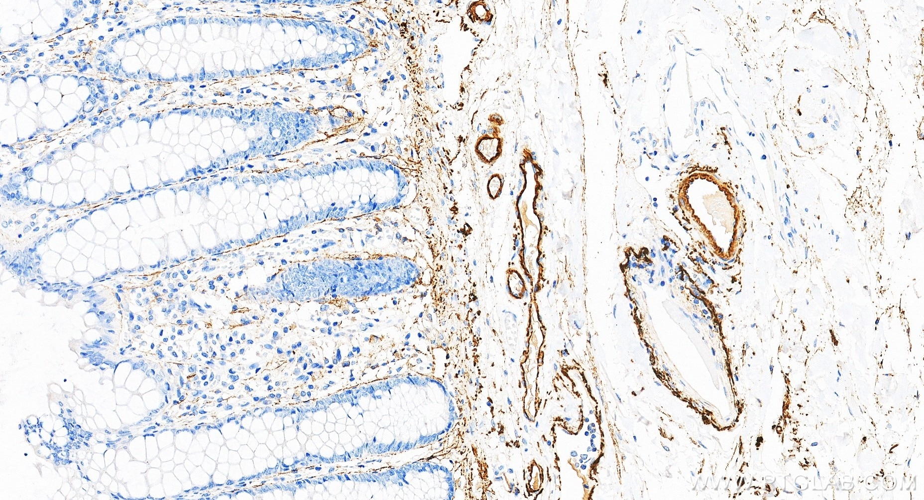 IHC staining of human colon using 88535-1-RR (same clone as 88535-1-PBS) Immunohistochemistry (IHC) staining of human colon tissue using MFAP4 Recombinant monoclonal antibody (88535-1-RR)