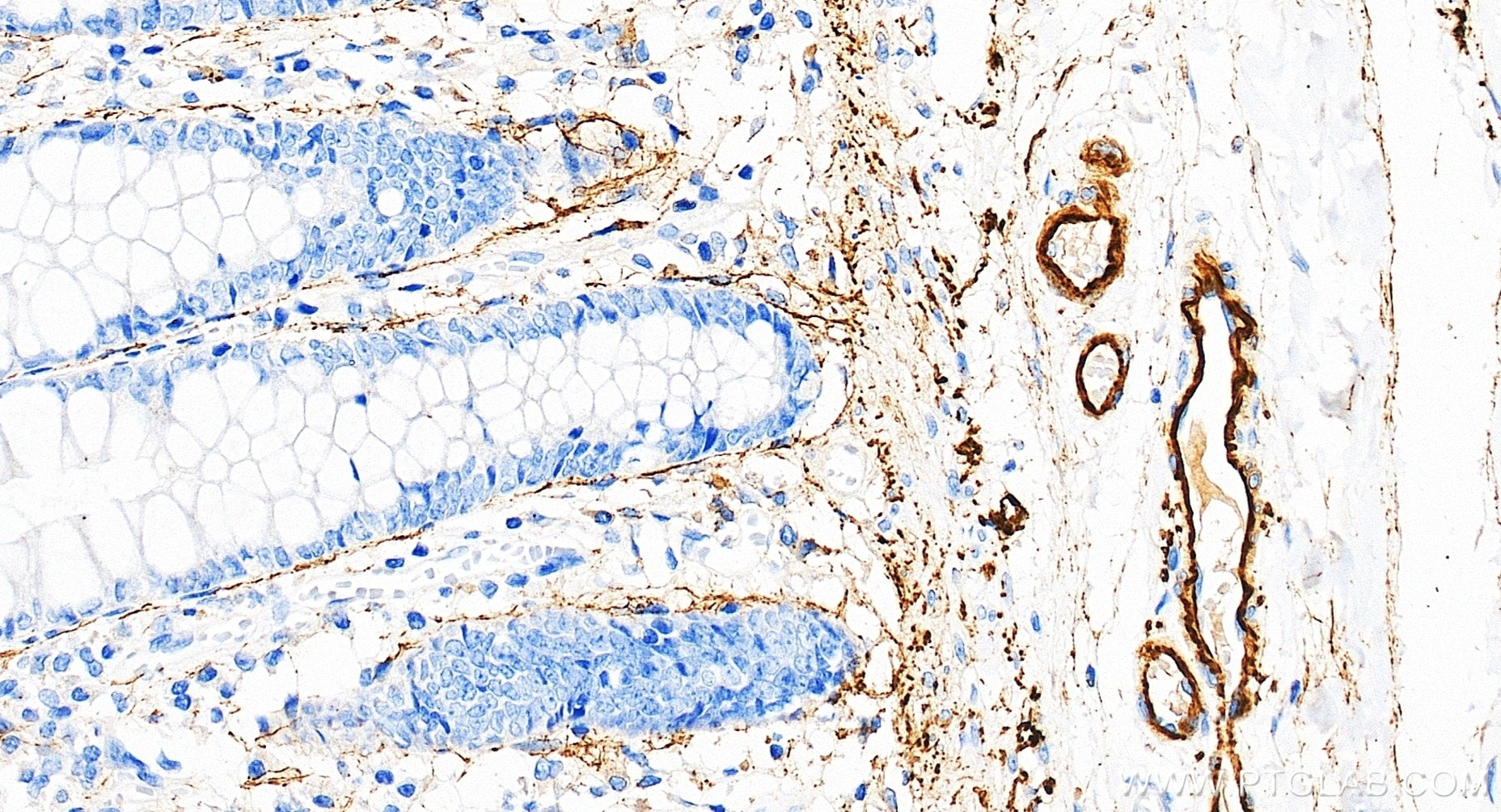 IHC staining of human colon using 88535-1-RR (same clone as 88535-1-PBS) Immunohistochemistry (IHC) staining of human colon tissue using MFAP4 Recombinant monoclonal antibody (88535-1-RR)