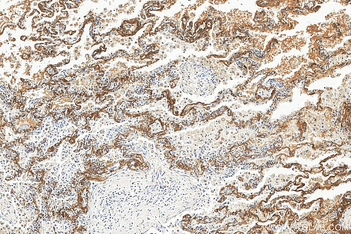 IHC staining of human lung using 88535-1-RR (same clone as 88535-1-PBS) Immunohistochemistry (IHC) staining of human lung tissue using MFAP4 Recombinant monoclonal antibody (88535-1-RR)