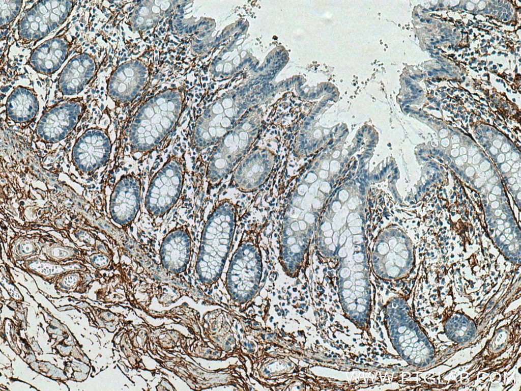 IHC staining of human colon using 15727-1-AP