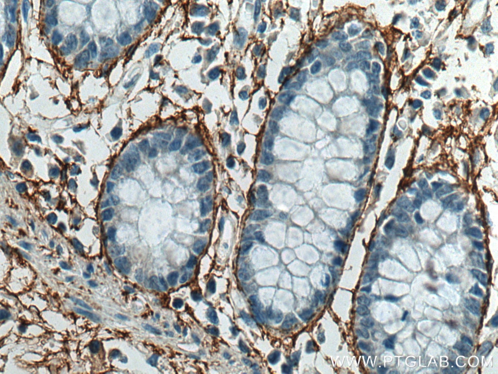 Immunohistochemistry (IHC) staining of human colon tissue using MFAP5 Polyclonal antibody (15727-1-AP)