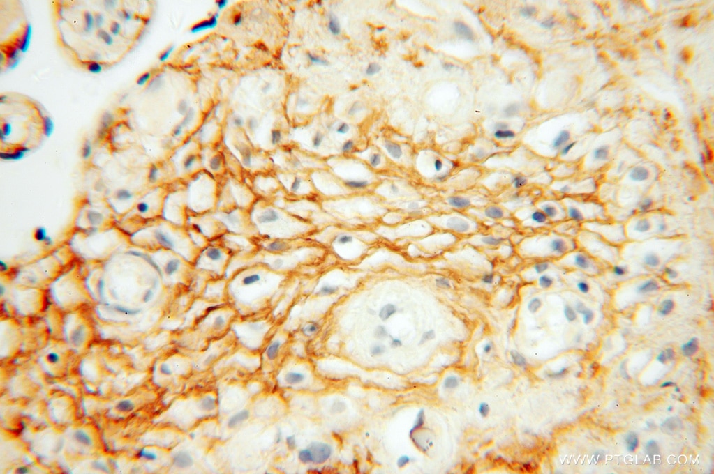 Immunohistochemistry (IHC) staining of human placenta tissue using MFAP5 Polyclonal antibody (15727-1-AP)