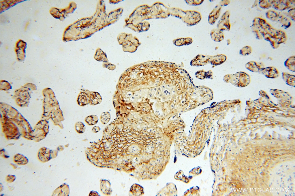 Immunohistochemistry (IHC) staining of human placenta tissue using MFAP5 Polyclonal antibody (15727-1-AP)