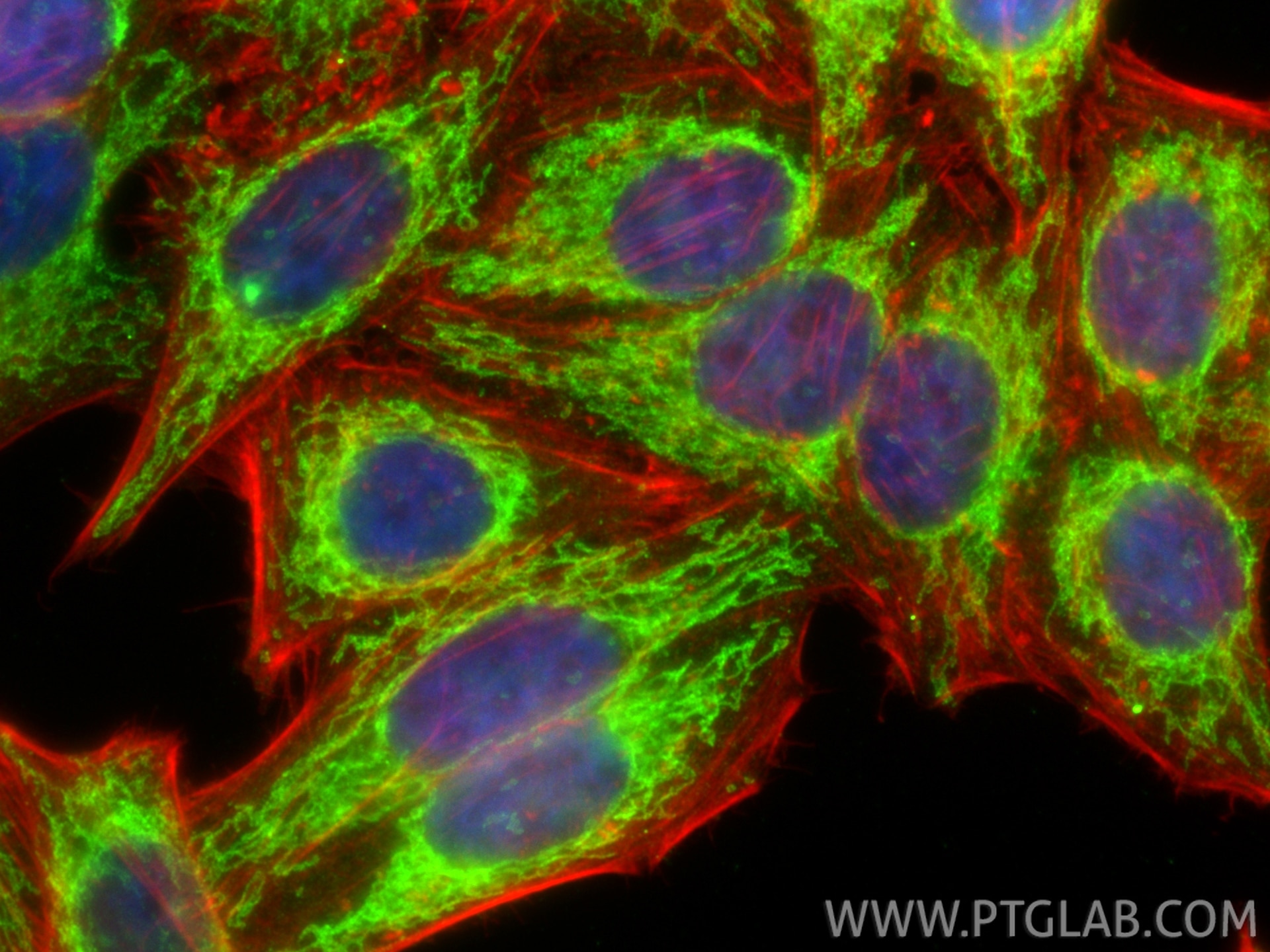 Immunofluorescence (IF) / fluorescent staining of HepG2 cells using MFF Polyclonal antibody (17090-1-AP)