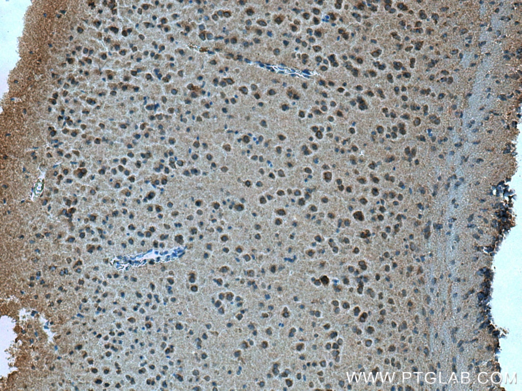 Immunohistochemistry (IHC) staining of mouse brain tissue using MFF Polyclonal antibody (17090-1-AP)
