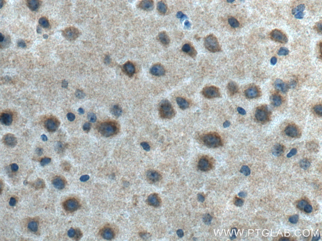 Immunohistochemistry (IHC) staining of mouse brain tissue using MFF Polyclonal antibody (17090-1-AP)