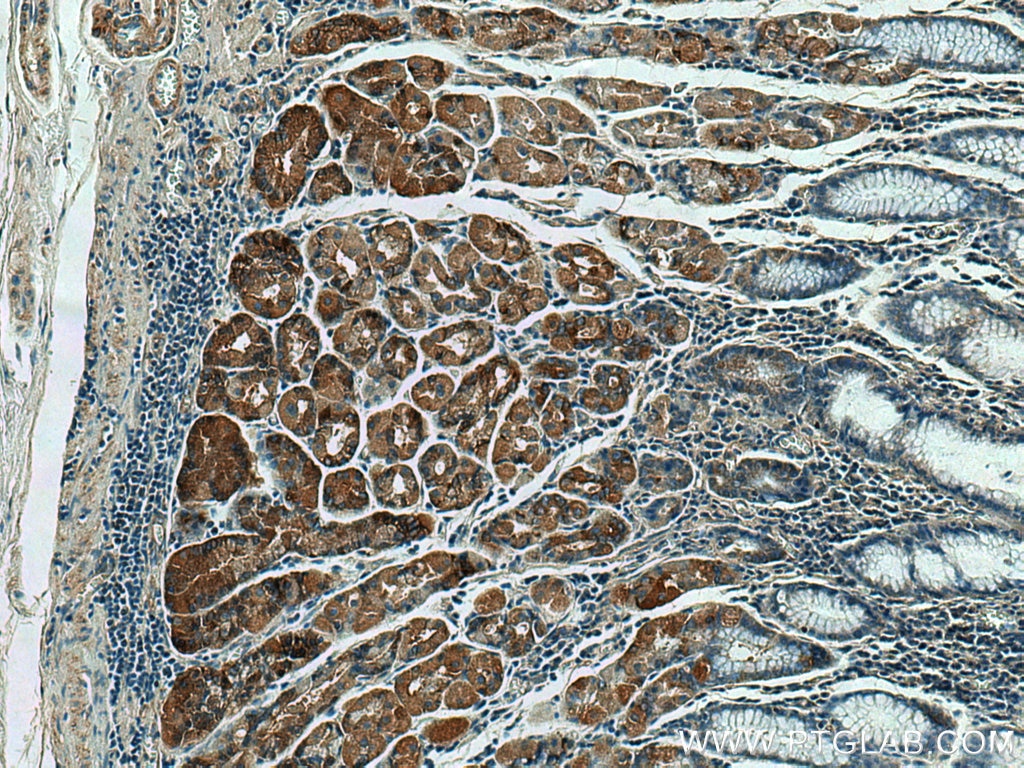 Immunohistochemistry (IHC) staining of human stomach tissue using MFF Polyclonal antibody (17090-1-AP)