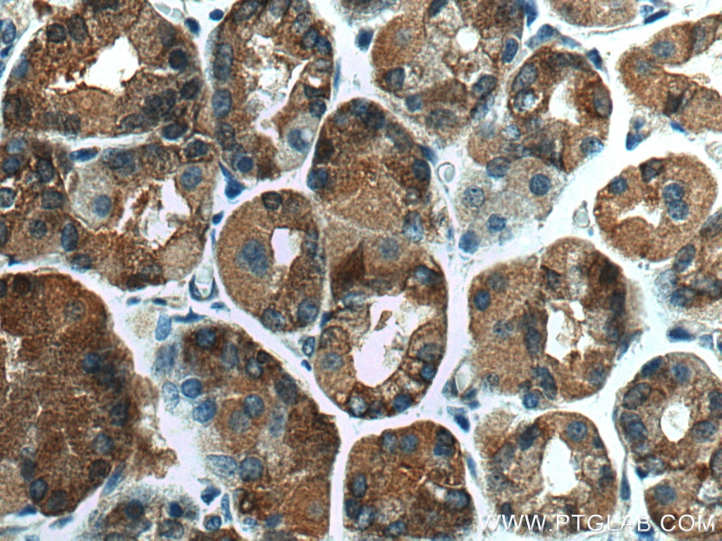 Immunohistochemistry (IHC) staining of human stomach tissue using MFF Polyclonal antibody (17090-1-AP)