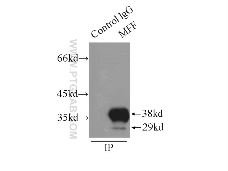 Immunoprecipitation (IP) experiment of mouse brain tissue using MFF Polyclonal antibody (17090-1-AP)