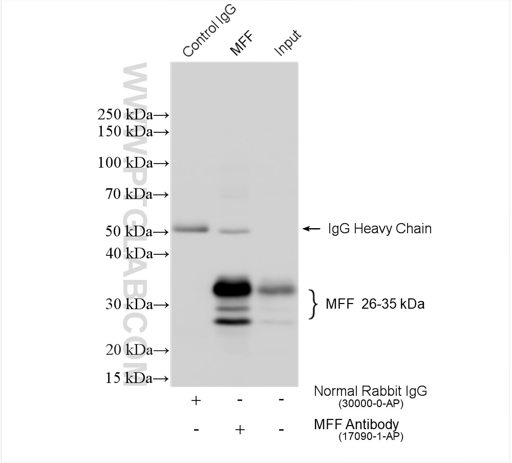 Immunoprecipitation (IP) experiment of mouse brain tissue using MFF Polyclonal antibody (17090-1-AP)