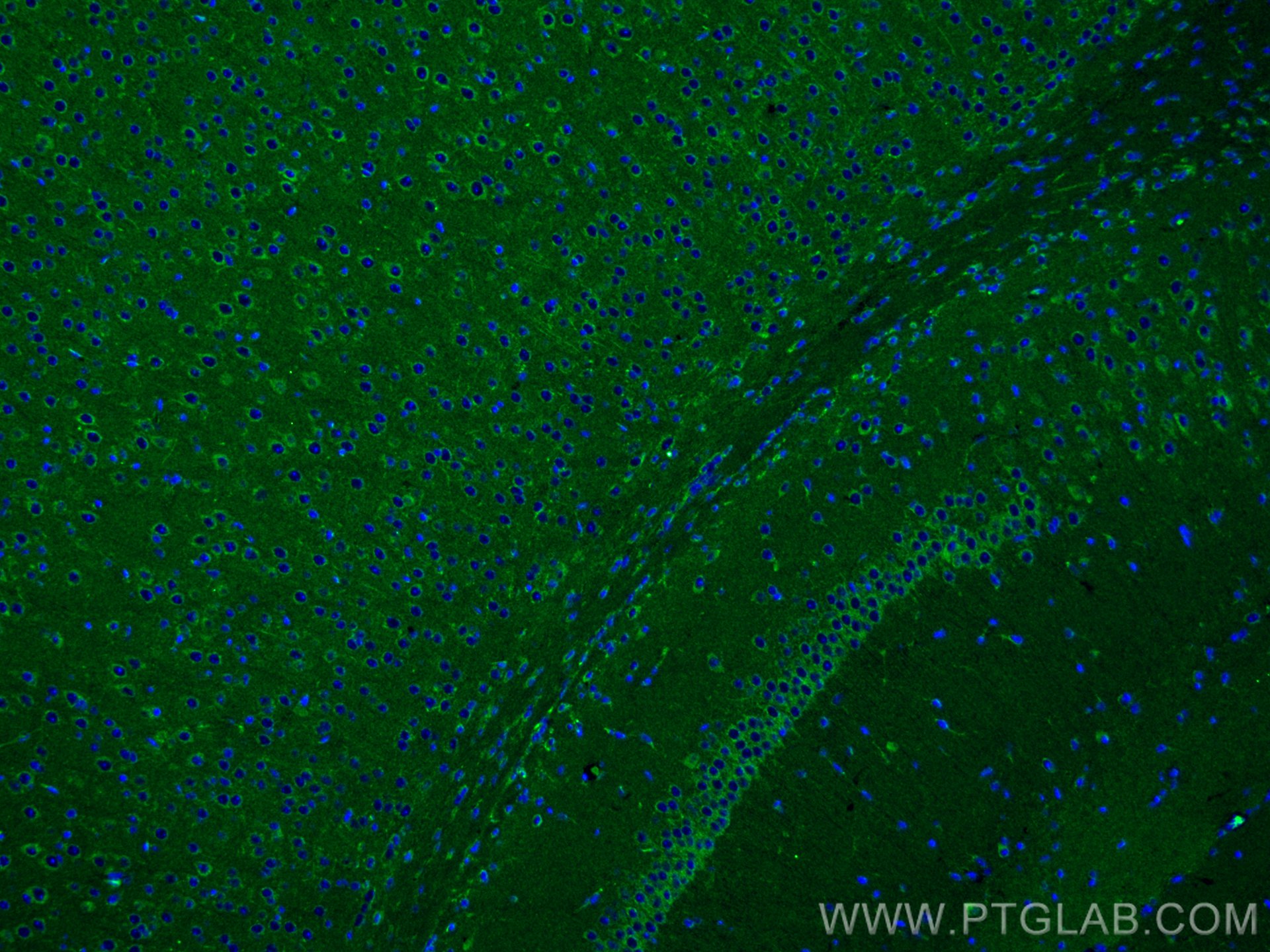 Immunofluorescence (IF) / fluorescent staining of mouse brain tissue using MFF Monoclonal antibody (66527-1-Ig)