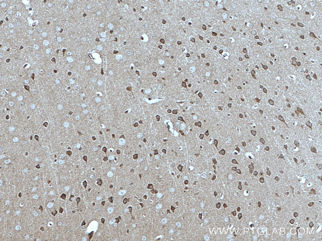 Immunohistochemistry (IHC) staining of mouse brain tissue using MFF Monoclonal antibody (66527-1-Ig)