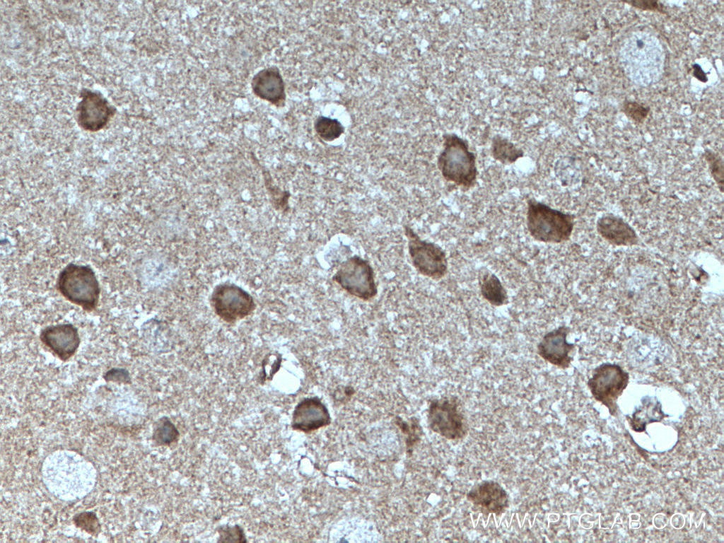 Immunohistochemistry (IHC) staining of mouse brain tissue using MFF Monoclonal antibody (66527-1-Ig)