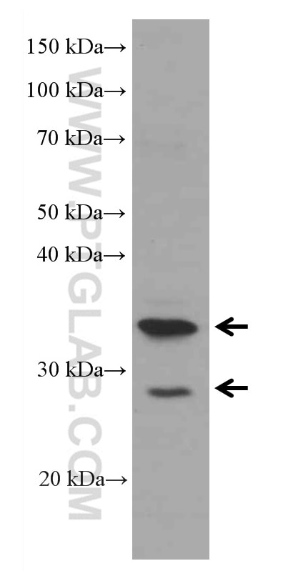 WB analysis of HepG2 using 66527-1-Ig