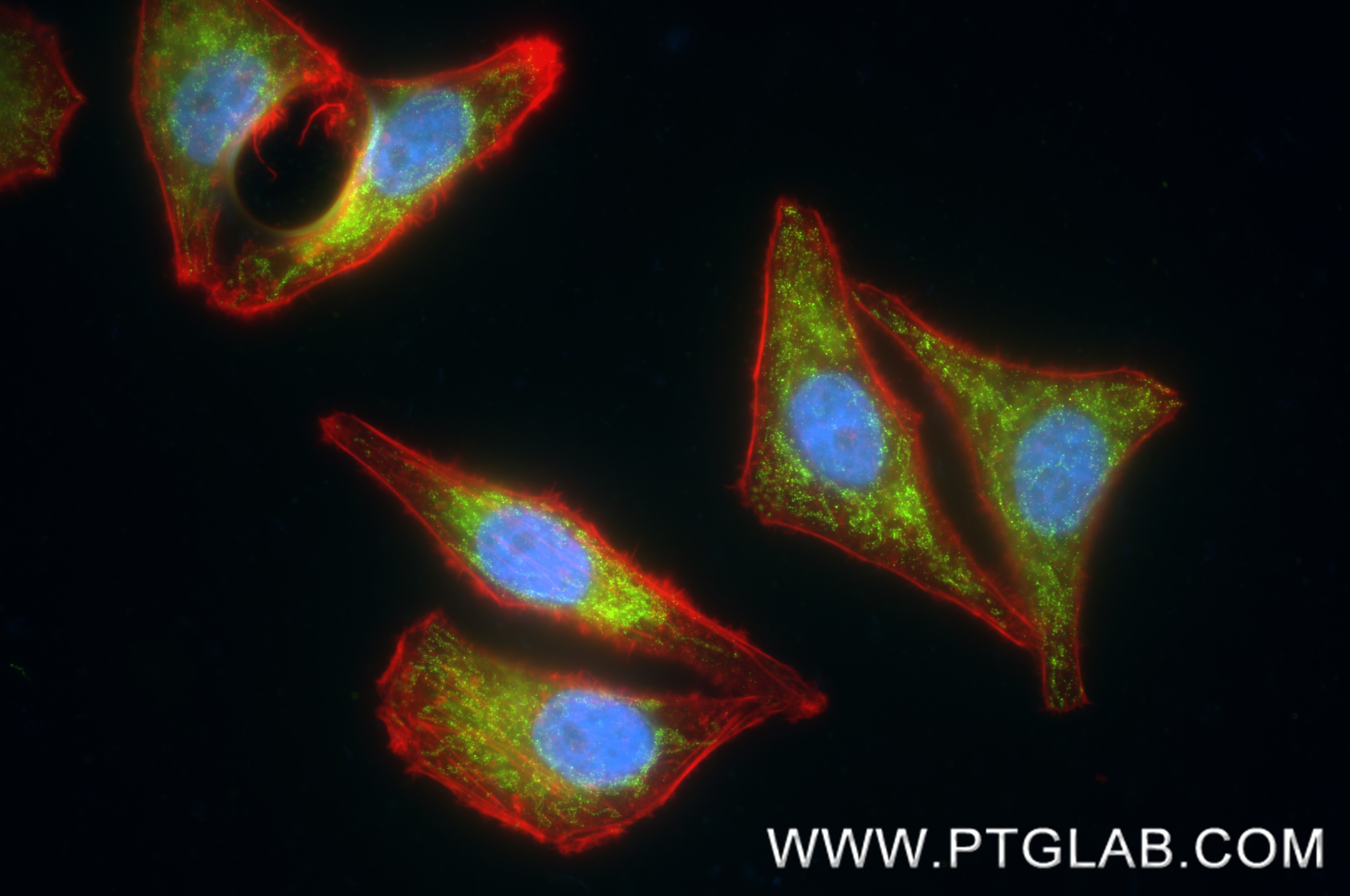 Immunofluorescence (IF) / fluorescent staining of HepG2 cells using MFF Recombinant monoclonal antibody (87972-1-RR)