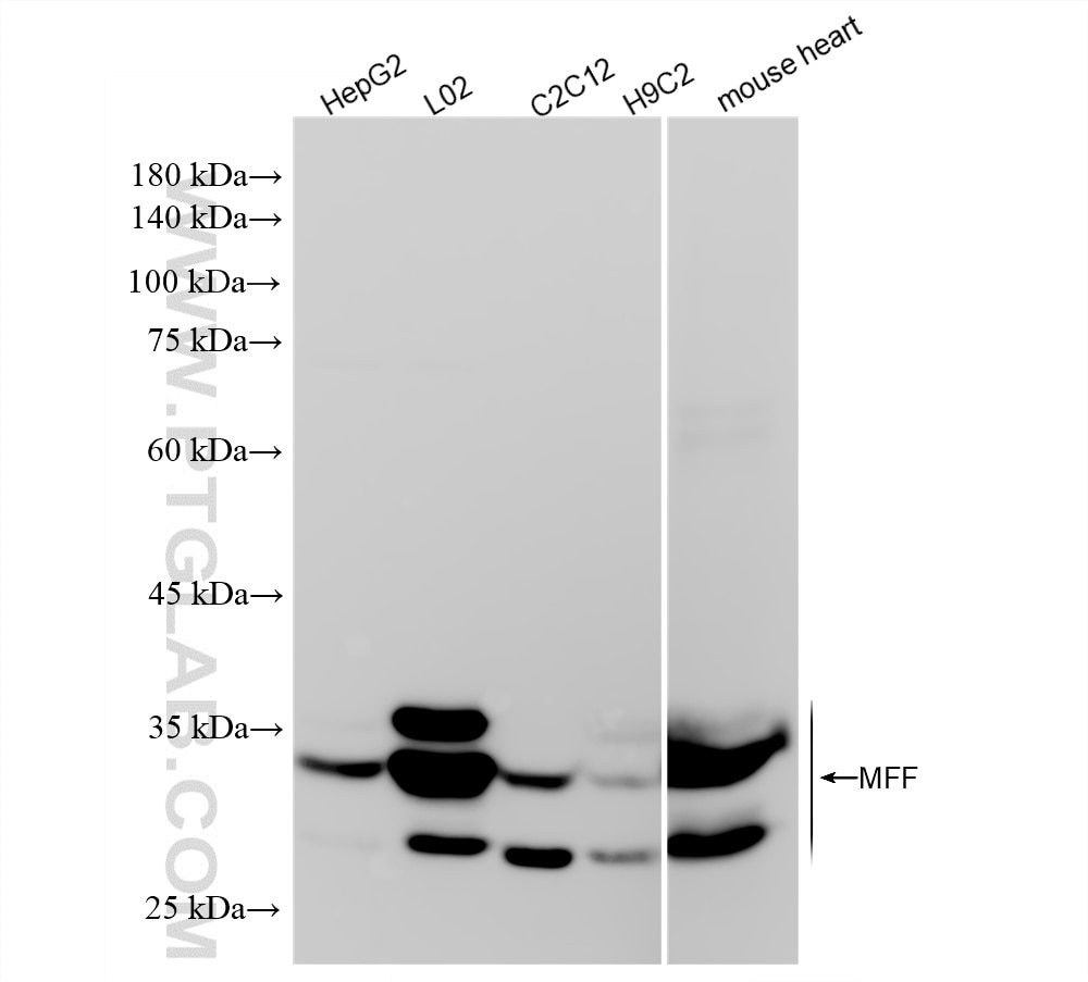 Western Blot (WB) analysis of various lysates using MFF Recombinant monoclonal antibody (87972-1-RR)