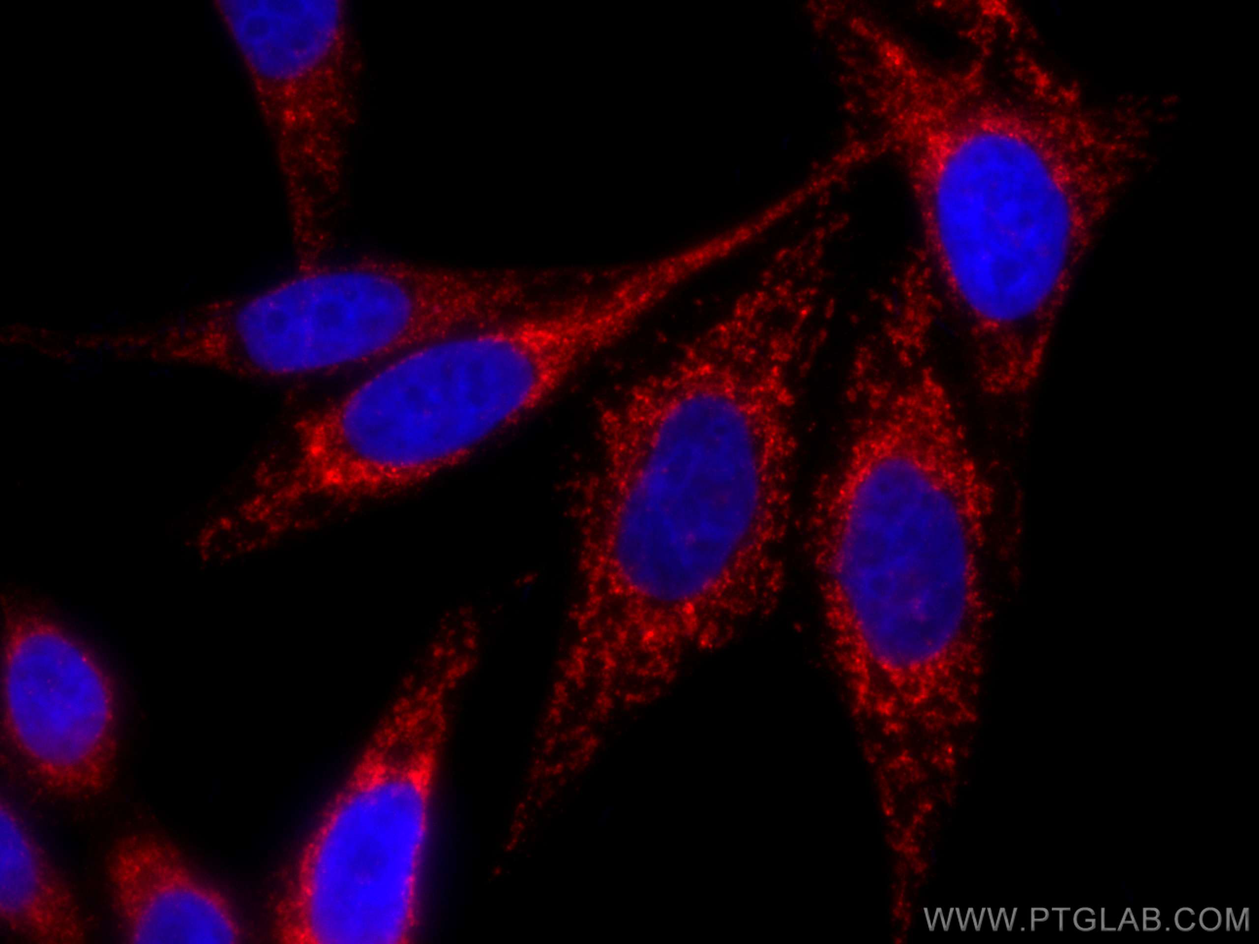 Immunofluorescence (IF) / fluorescent staining of HepG2 cells using CoraLite®594-conjugated MFF Polyclonal antibody (CL594-17090)