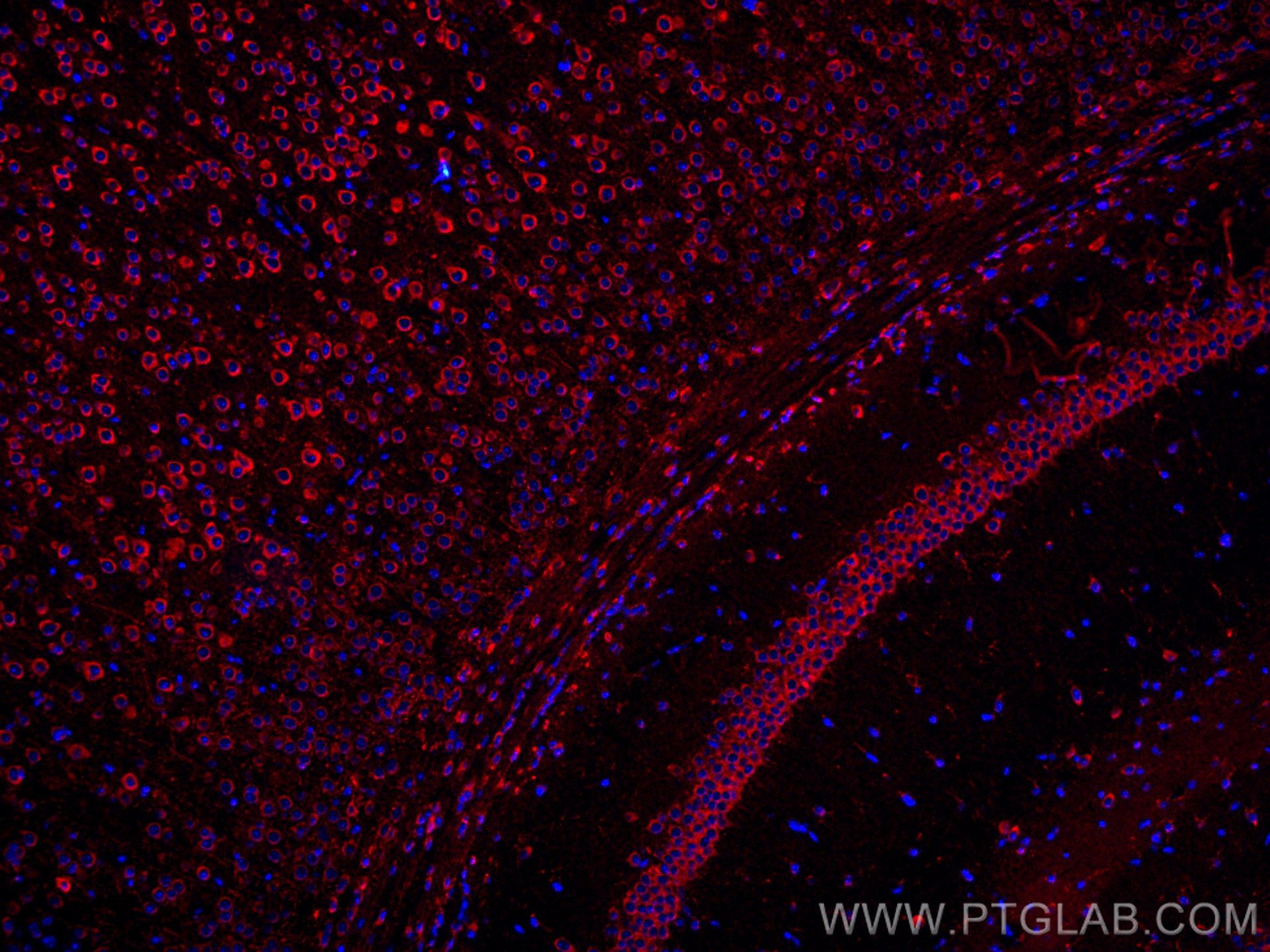 Immunofluorescence (IF) / fluorescent staining of mouse brain tissue using CoraLite®594-conjugated MFF Monoclonal antibody (CL594-66527)
