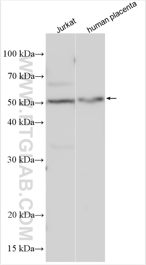 Western Blot (WB) analysis of various lysates using MFG-E8 Polyclonal antibody (25951-1-AP)