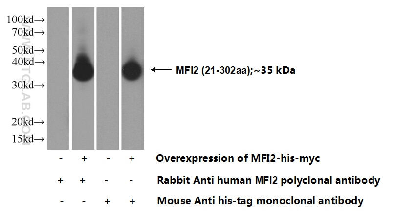 Western Blot (WB) analysis of Transfected HEK-293 cells using MFI2 Polyclonal antibody (10428-1-AP)