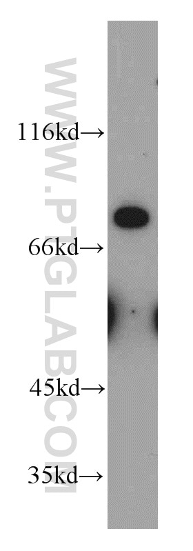 Western Blot (WB) analysis of HEK-293 cells using MFI2 Polyclonal antibody (10428-1-AP)