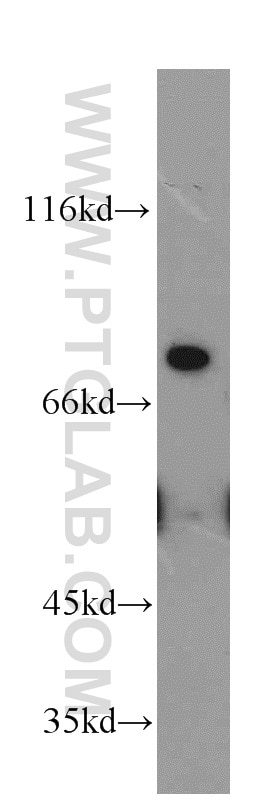 Western Blot (WB) analysis of HeLa cells using MFI2 Polyclonal antibody (10428-1-AP)