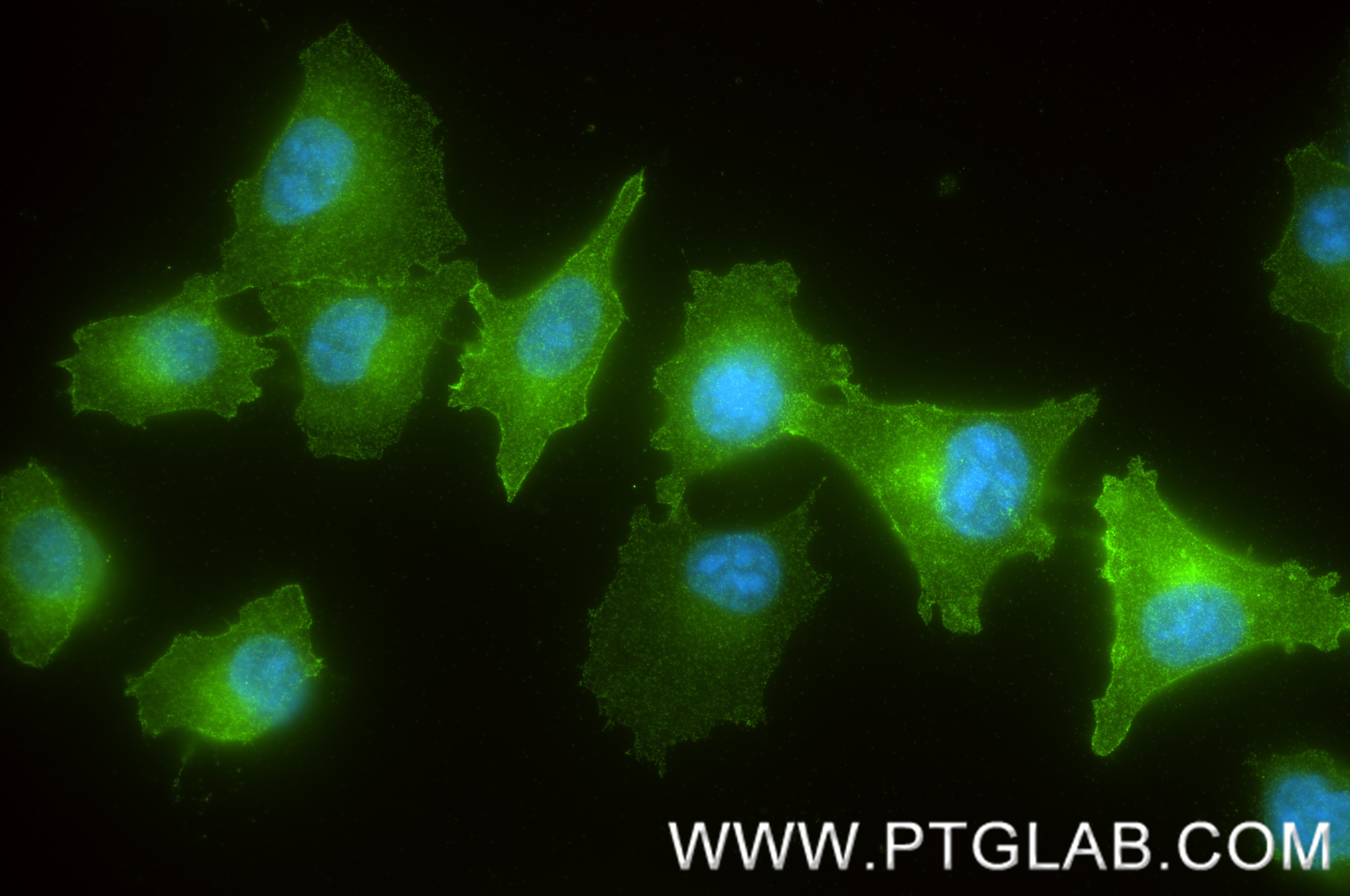 IF Staining of A375 using 88127-1-RR (same clone as 88127-1-PBS) Immunofluorescence (IF) / fluorescent staining of A375 cells using MFI2 Recombinant monoclonal antibody (88127-1-RR)