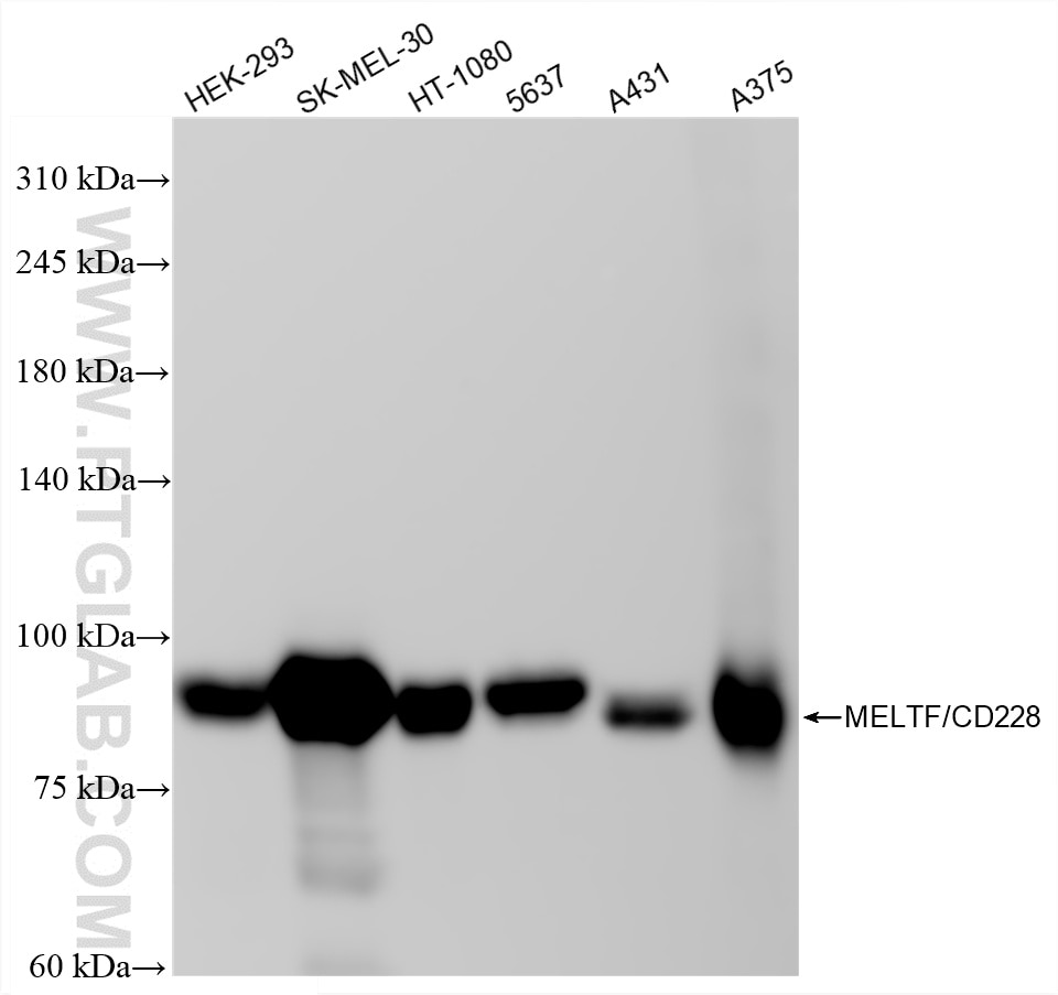 WB analysis using 88127-1-RR (same clone as 88127-1-PBS) Western Blot (WB) analysis of various lysates using MFI2 Recombinant monoclonal antibody (88127-1-RR)