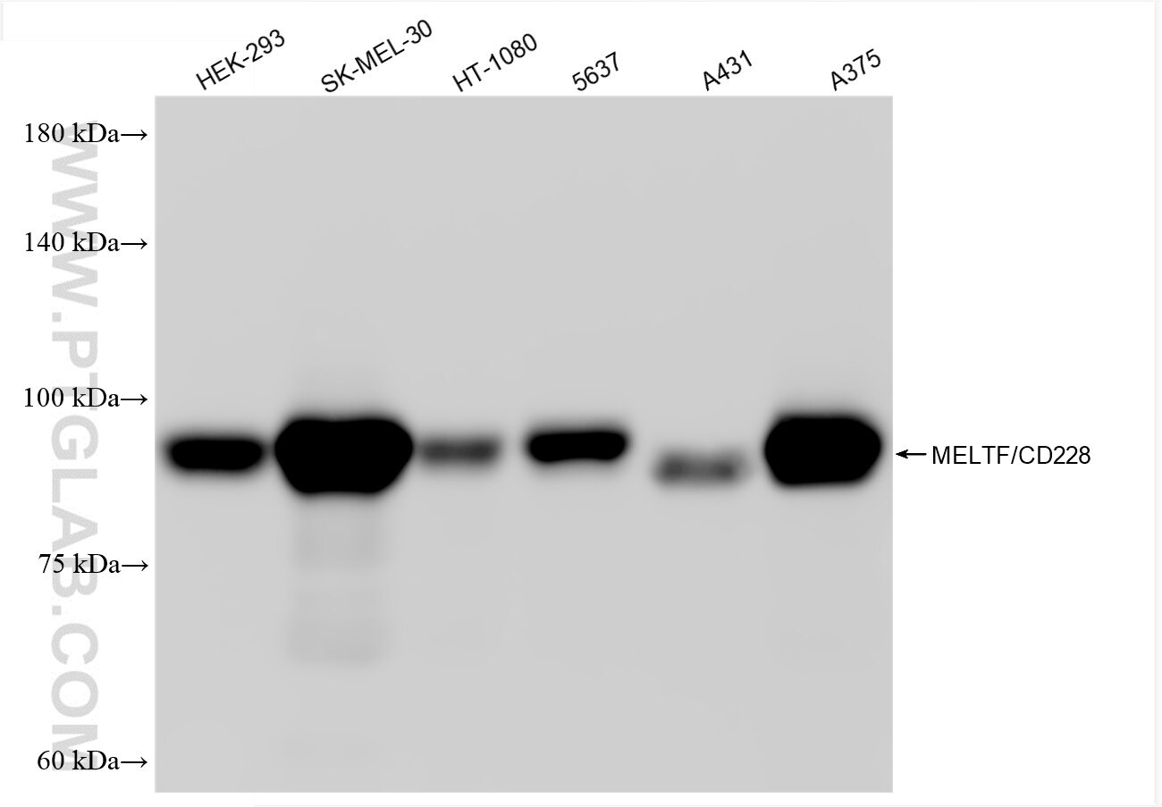 WB analysis using 88127-2-RR Western Blot (WB) analysis of various lysates using MFI2 Recombinant monoclonal antibody (88127-2-RR)