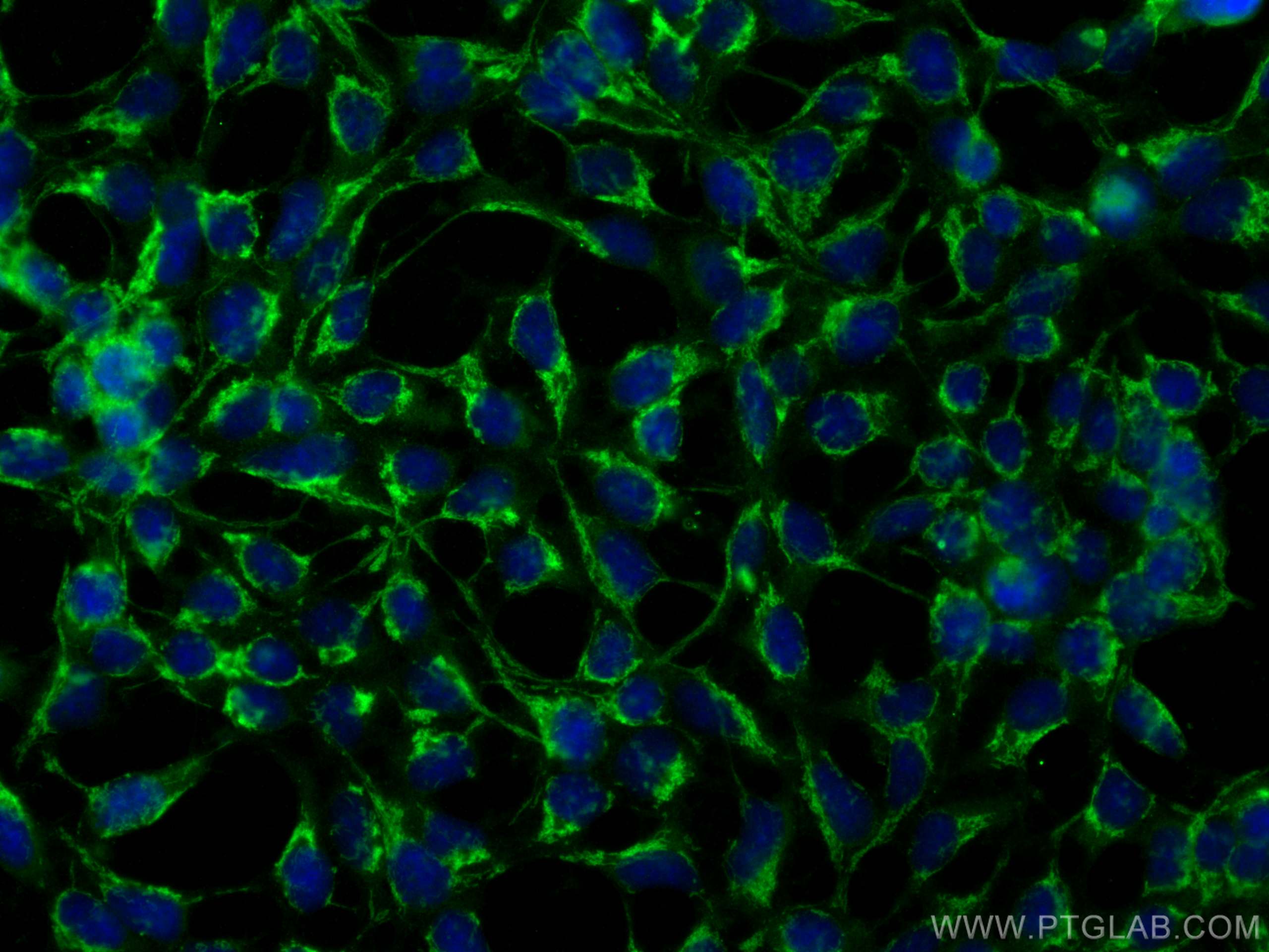 Immunofluorescence (IF) / fluorescent staining of HEK-293 cells using MFN1 Polyclonal antibody (13798-1-AP)