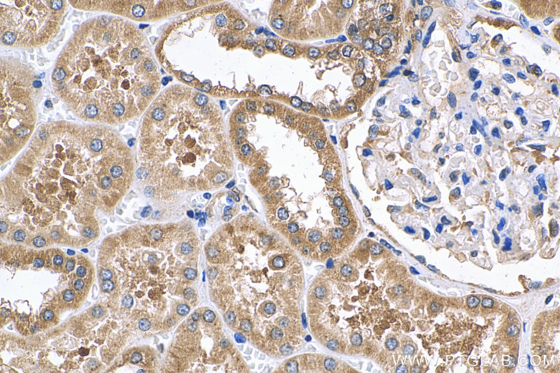 Immunohistochemistry (IHC) staining of human kidney tissue using MFN1 Polyclonal antibody (13798-1-AP)