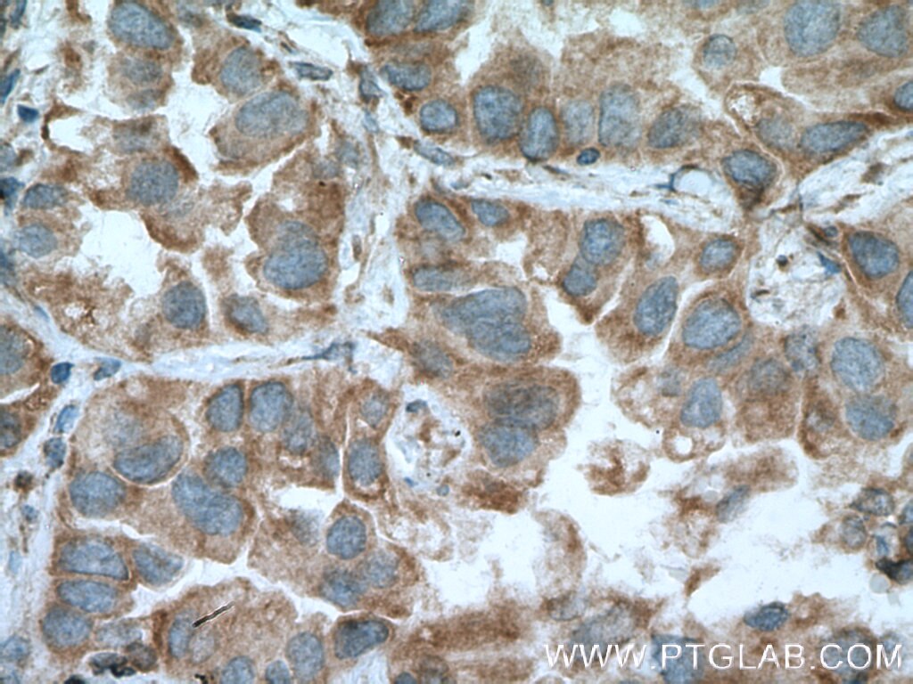 MFN1 Polyclonal antibody