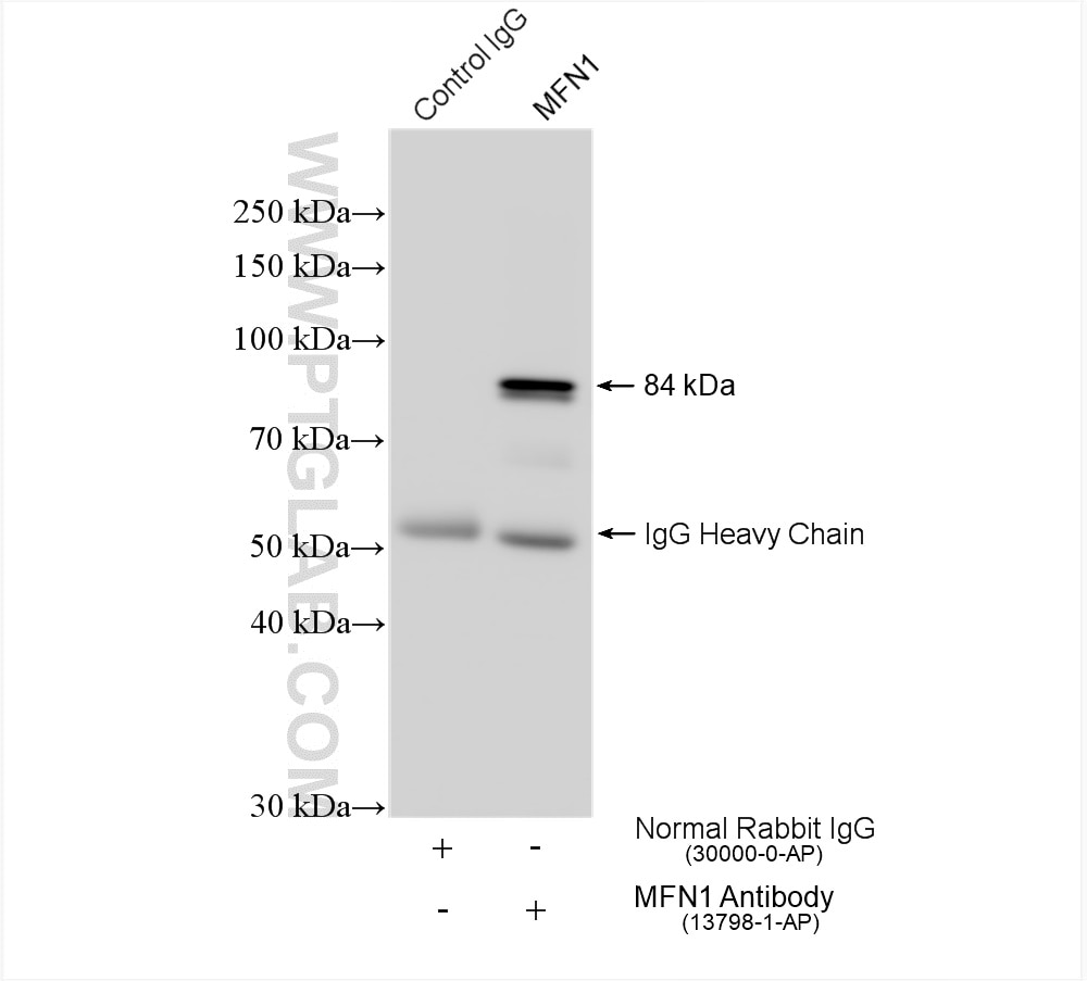 Immunoprecipitation (IP) experiment of mouse kidney tissue using MFN1 Polyclonal antibody (13798-1-AP)