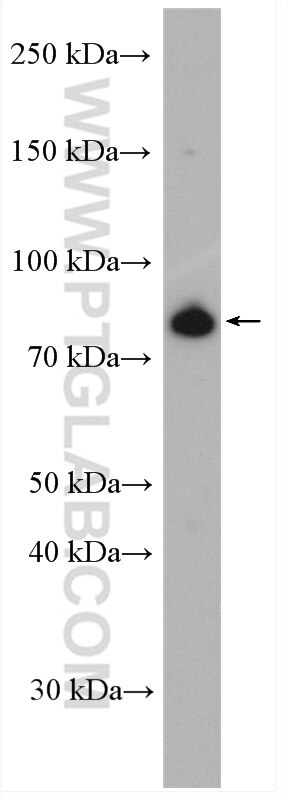 Western Blot (WB) analysis of HeLa cells using MFN1 Polyclonal antibody (13798-1-AP)