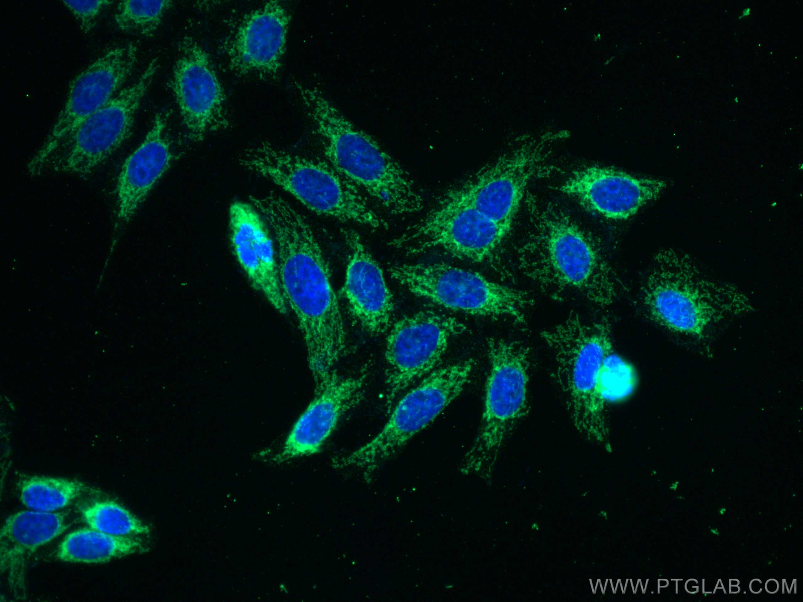 Immunofluorescence (IF) / fluorescent staining of HepG2 cells using MFN1 Monoclonal antibody (66776-1-Ig)