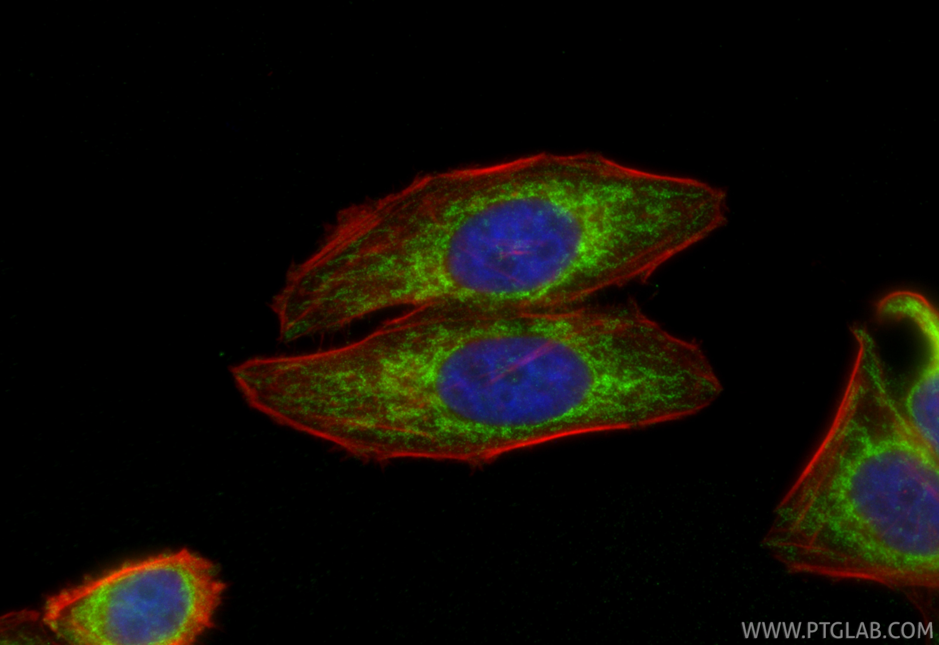 IF Staining of HepG2 using 66776-1-Ig Immunofluorescence (IF) / fluorescent staining of HepG2 cells using MFN1 Monoclonal antibody (66776-1-Ig)