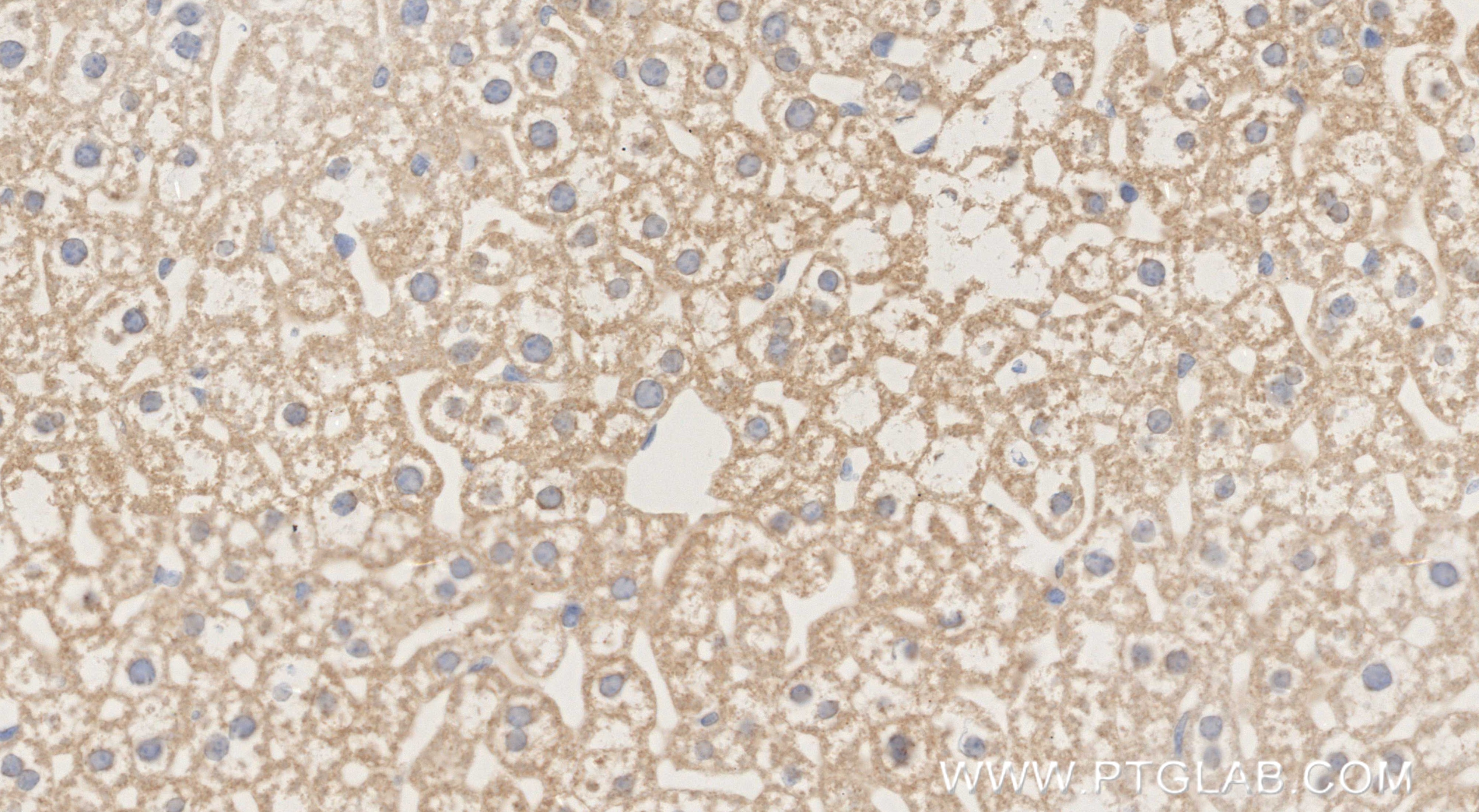Immunohistochemistry (IHC) staining of mouse liver tissue using MFN1 Recombinant monoclonal antibody (87246-1-RR)