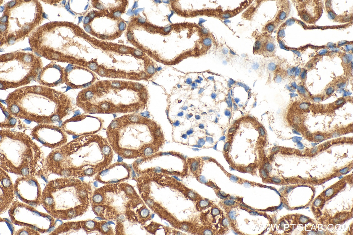 Immunohistochemistry (IHC) staining of mouse kidney tissue using MFN2 Polyclonal antibody (12186-1-AP)