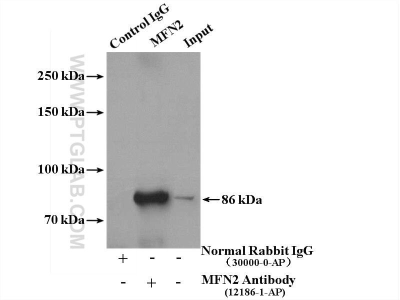 Immunoprecipitation (IP) experiment of mouse kidney tissue using MFN2 Polyclonal antibody (12186-1-AP)