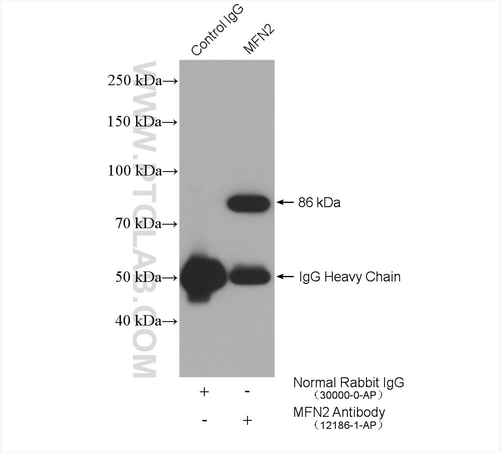 Immunoprecipitation (IP) experiment of mouse kidney tissue using MFN2 Polyclonal antibody (12186-1-AP)