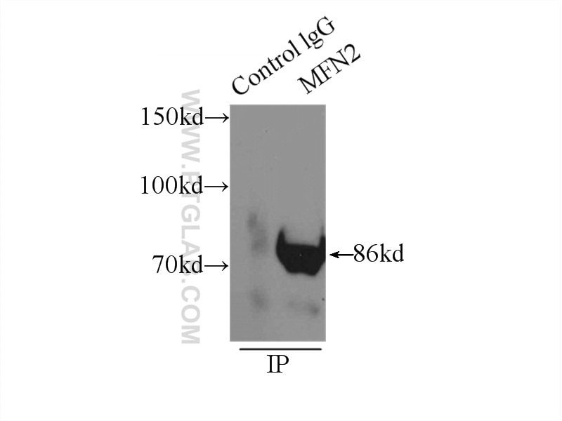 MFN2 Polyclonal antibody