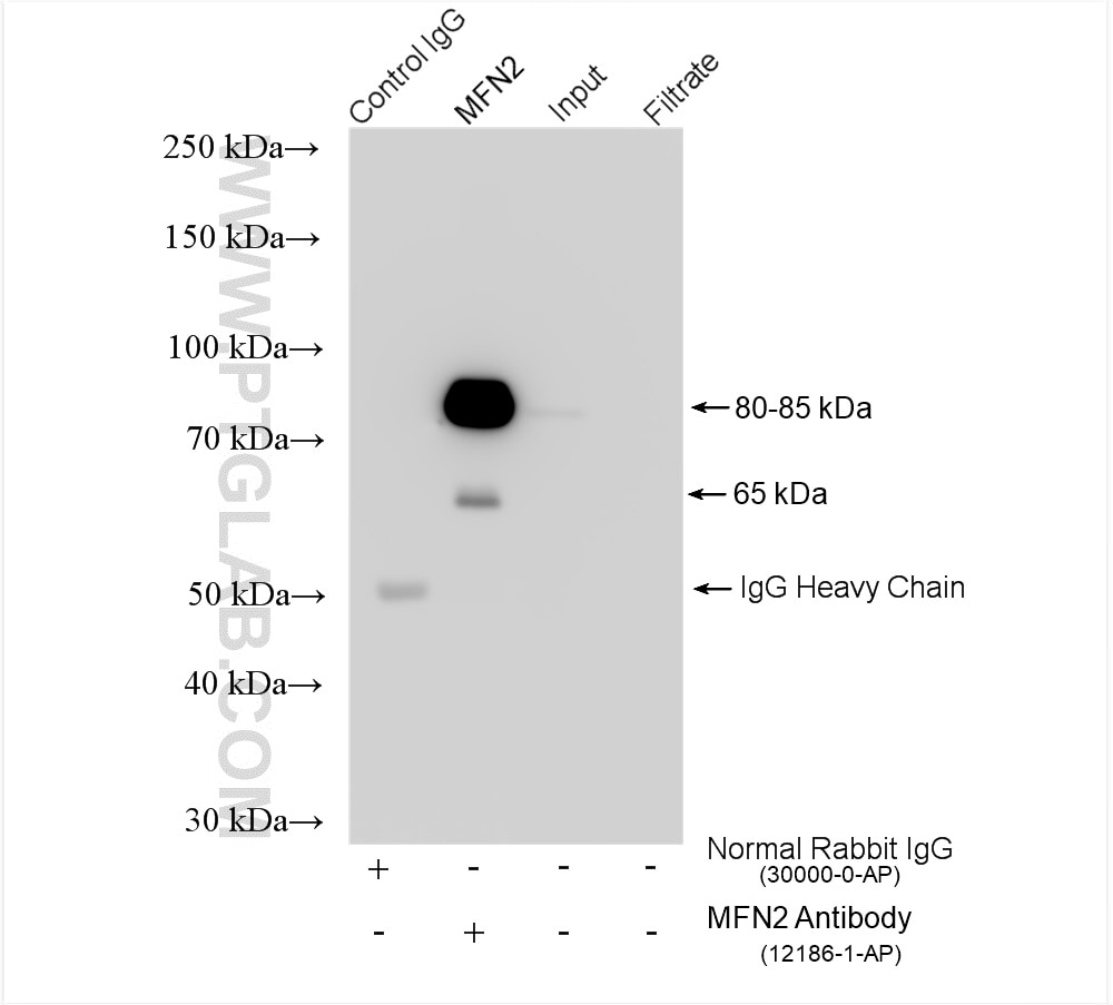 Immunoprecipitation (IP) experiment of mouse kidney tissue using MFN2 Polyclonal antibody (12186-1-AP)