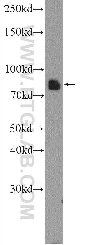 Western Blot (WB) analysis of COLO 320 cells using MFN2 Polyclonal antibody (12186-1-AP)