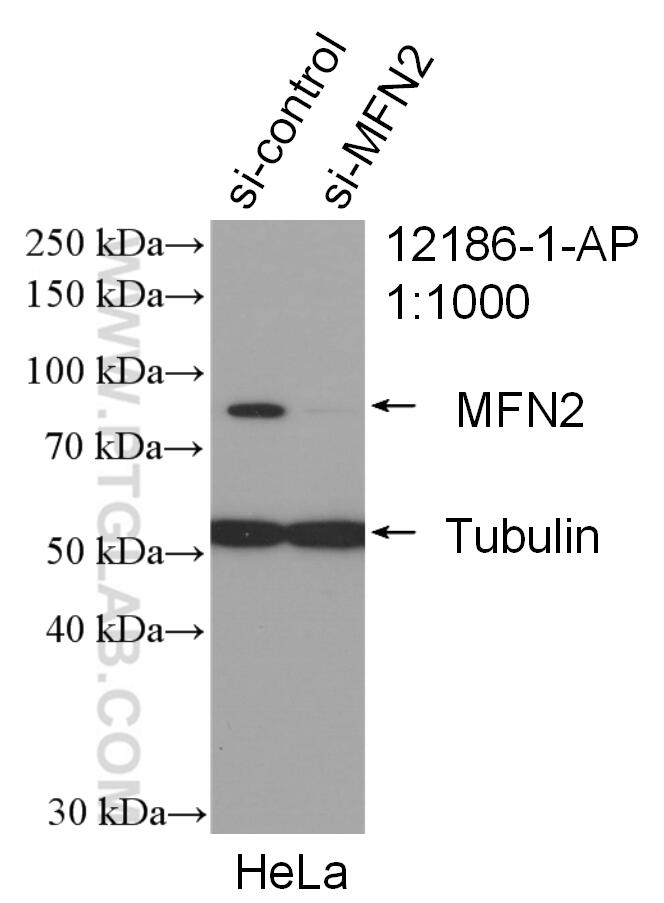 Western Blot (WB) analysis of HeLa cells using MFN2 Polyclonal antibody (12186-1-AP)