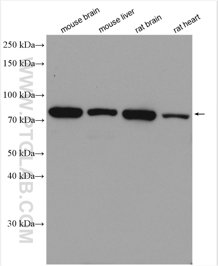 Western Blot (WB) analysis of various lysates using MFN2 Polyclonal antibody (12186-1-AP)