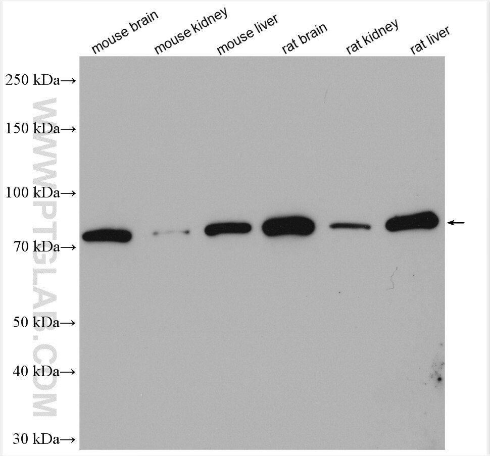 Western Blot (WB) analysis of various lysates using MFN2 Polyclonal antibody (12186-1-AP)