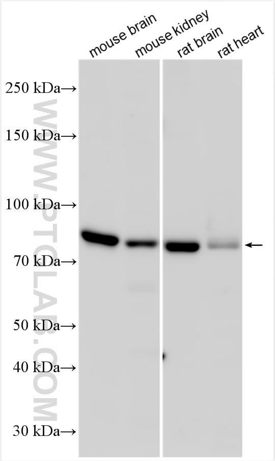 Western Blot (WB) analysis of various lysates using MFN2 Polyclonal antibody (12186-1-AP)